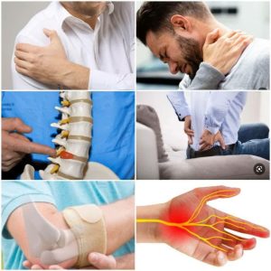 طب سنتی تول گیری