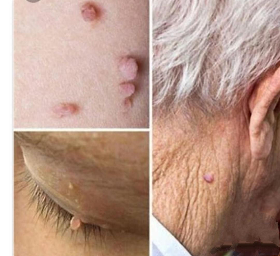 کلینیک لیزرخال زیگل کایروپراکتیک حجامت زالو بوتاکس