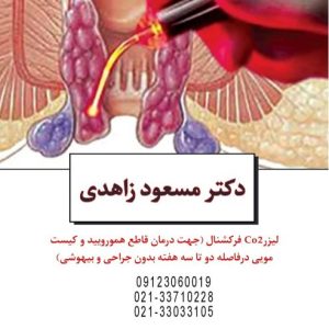 درمان قطعی هموروئید با لیزر در پیروزی