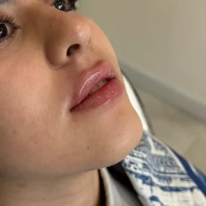 جشنواره بلک فرایدی کلینیک زیبایی میرای – تخفیف ویژه خدمات زیبایی