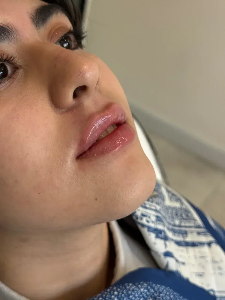 جشنواره بلک فرایدی کلینیک زیبایی میرای – تخفیف ویژه خدمات زیبایی