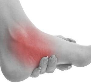 اسکن کف پا در غرب تهران