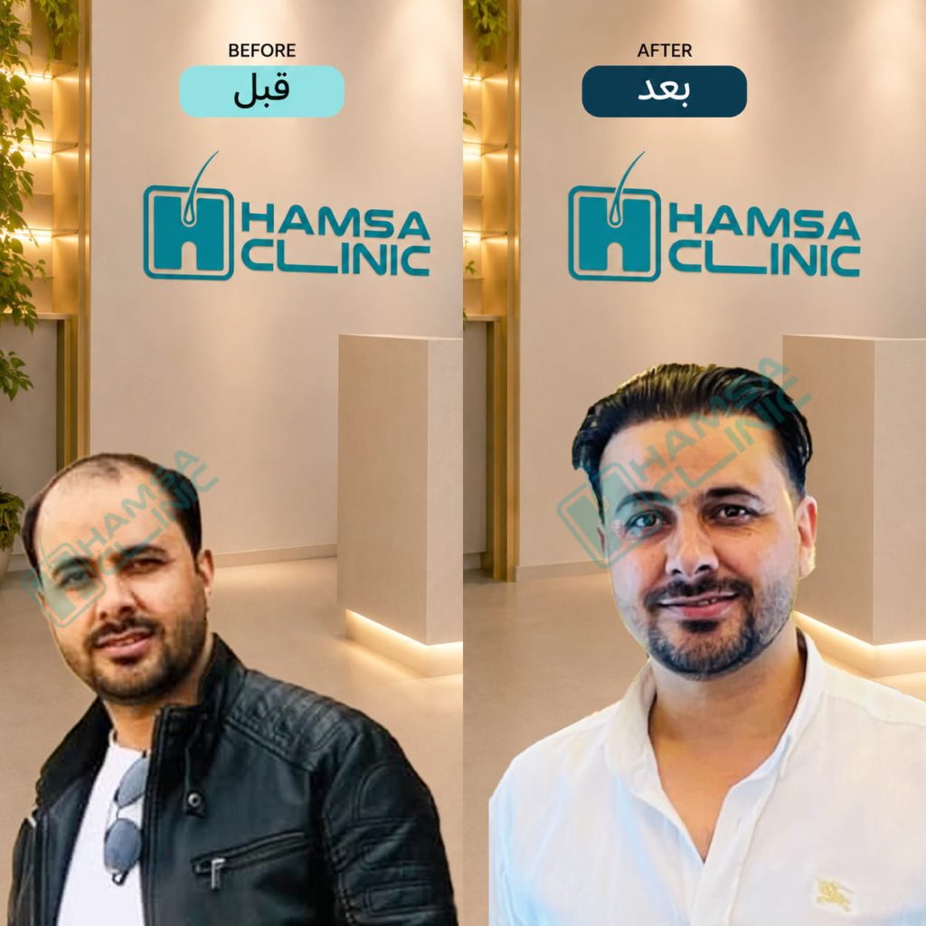 کلینیک کاشت مو و زیبایی همسا