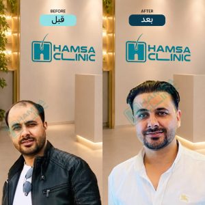 کلینیک کاشت مو و زیبایی همسا